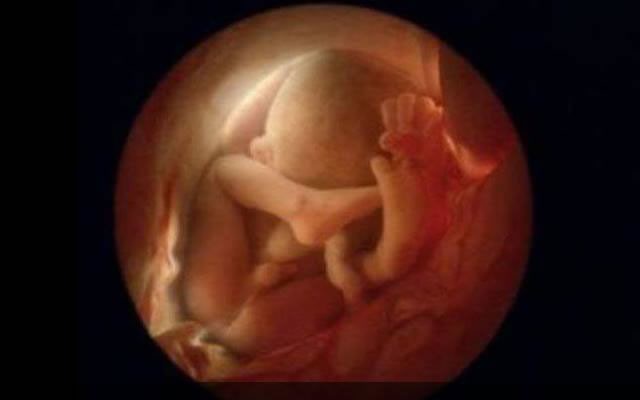 12 Haftalık Bebek Ultrason Görüntüleri